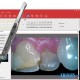 Handy TouchMi Dental Digital Intraoral Camera (TouchMi) by www.3nitysupply.com 