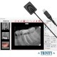 HDR-461 Dental X-Ray Digital Sensor Size# 2.0 with Software included (HDR-461) by www.3nitysupply.com