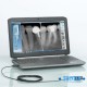 Owandy Intraoral Opteo Digital Dental X-Ray Sensor Size # 1 (Opteo#1) by www.3nitysupply.com 